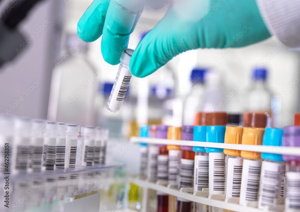 The Rising Tide of Early-Onset Cancer